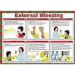 External Bleeding Poster